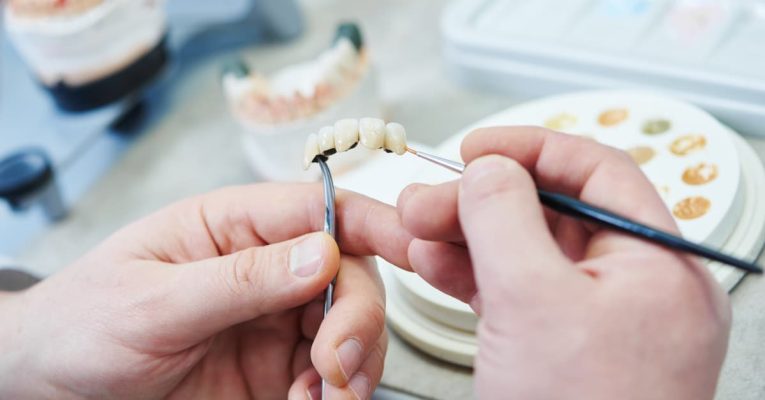 Devenir Prothésiste dentaire : missions, salaire et formation